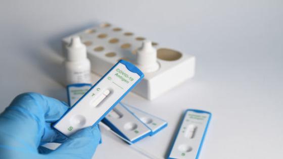الحكومة تتخد قراراً بشأن تسعيرة تحاليل تشخيص كورونا “PCR”
